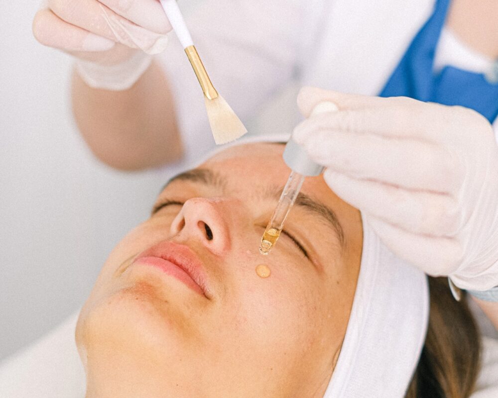 Woman receiving chemical peel